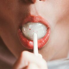 ©Marta González Gómez - Carne de perro - 3 ©Marta González Gómez - Carne de perro - 3